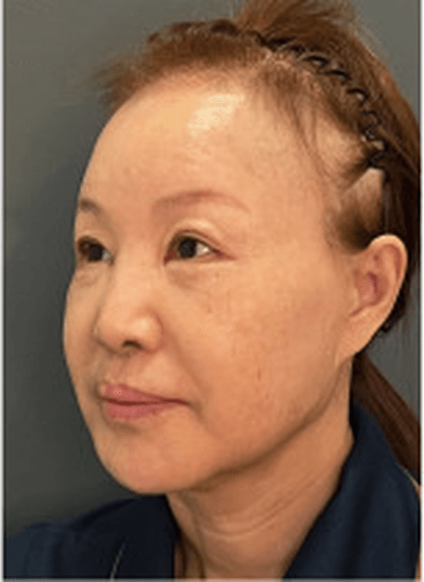 Pre-operative photograph, oblique view